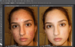 How to Remove Skin Blemishes in Photoshop...